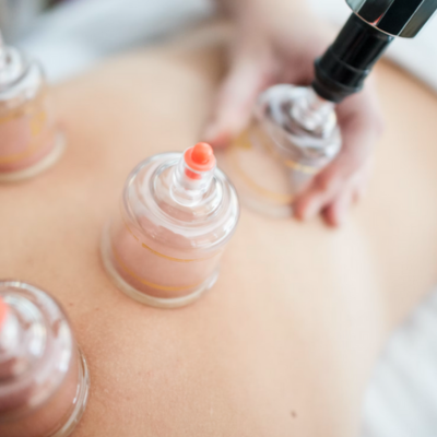 Cupping Therapie